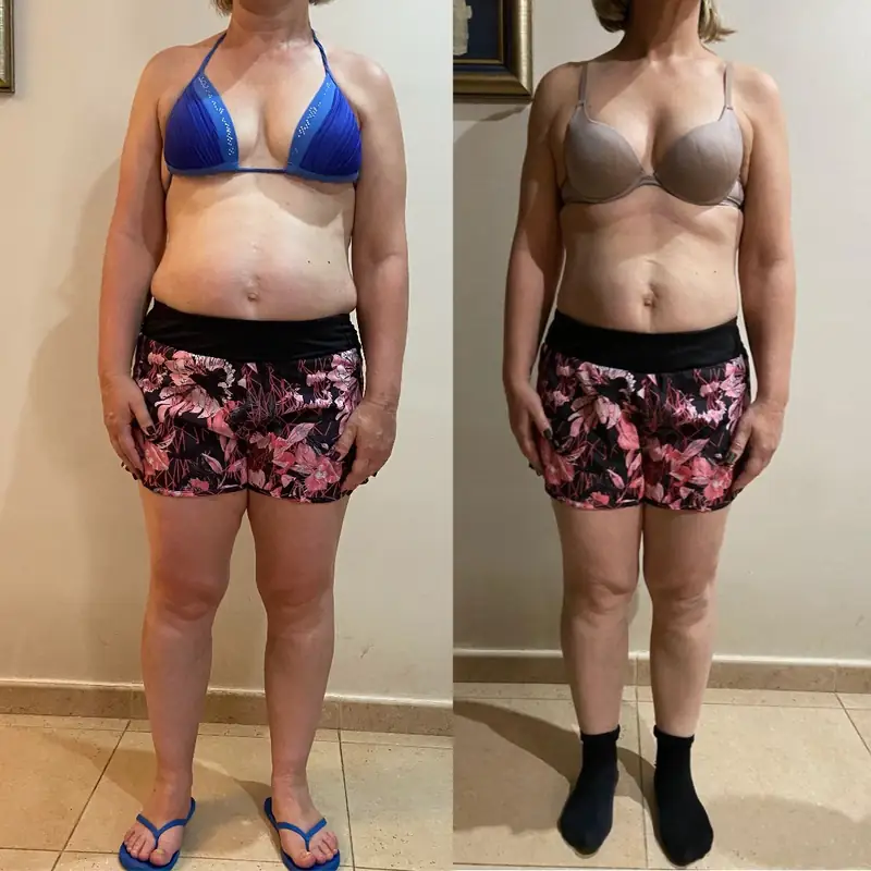 Cambio real: antes y después