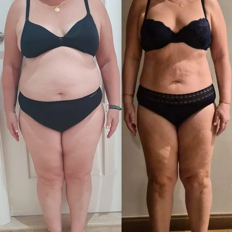 Cambio real: antes y después